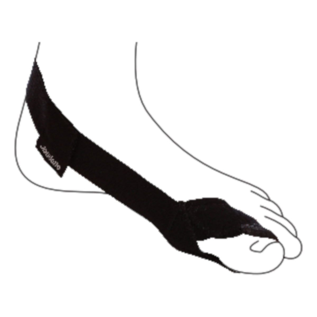 Hallux Valgus